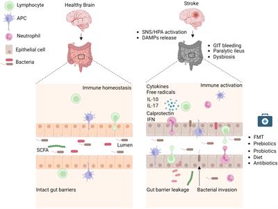 Ischemic stroke and concomitant gastrointestinal complications- a fatal combination for patient recovery